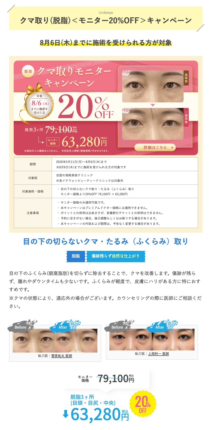 キャンペーン内容