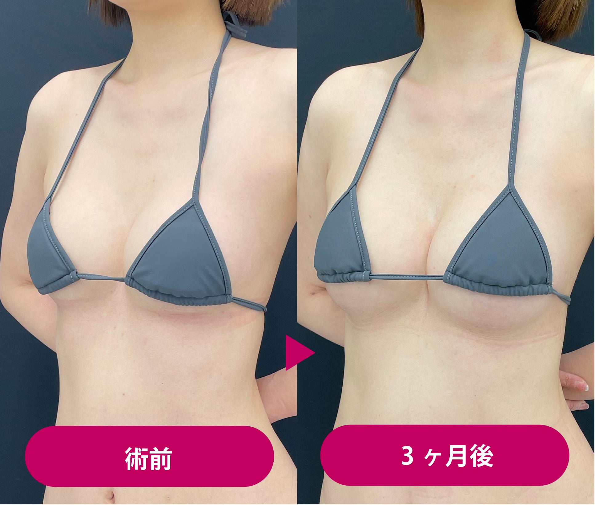 当時のメディア報道・掲載写真