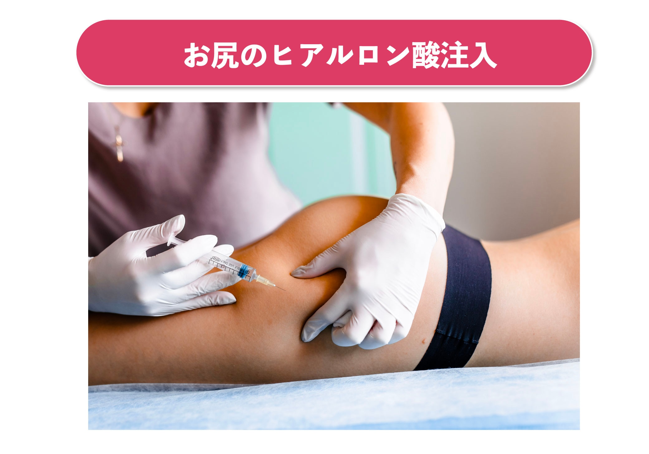 お尻　　注射 垂れ尻が治らない人必見！おしりの形を綺麗にする話題の豊尻手術について解説！ - 銀座院