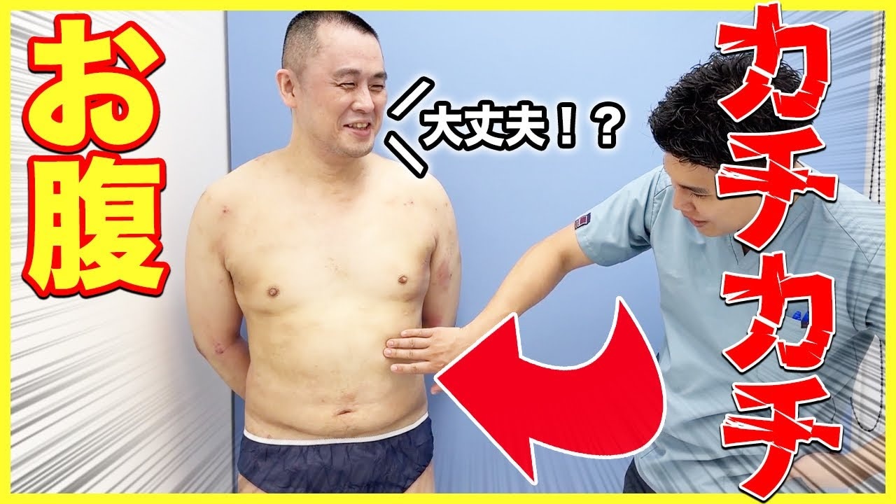 脂肪吸引は痛い？拘縮やダウンタイムの様子をお腹痩せした男性体験者に聞いてみた！