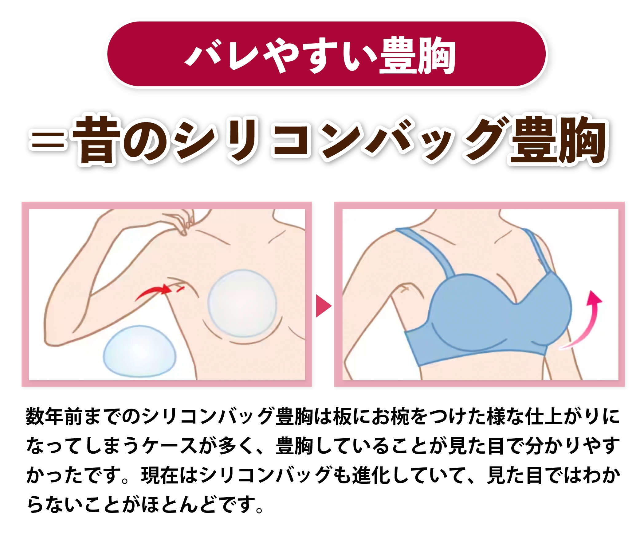 日本人 偽物豊胸おっぱい 