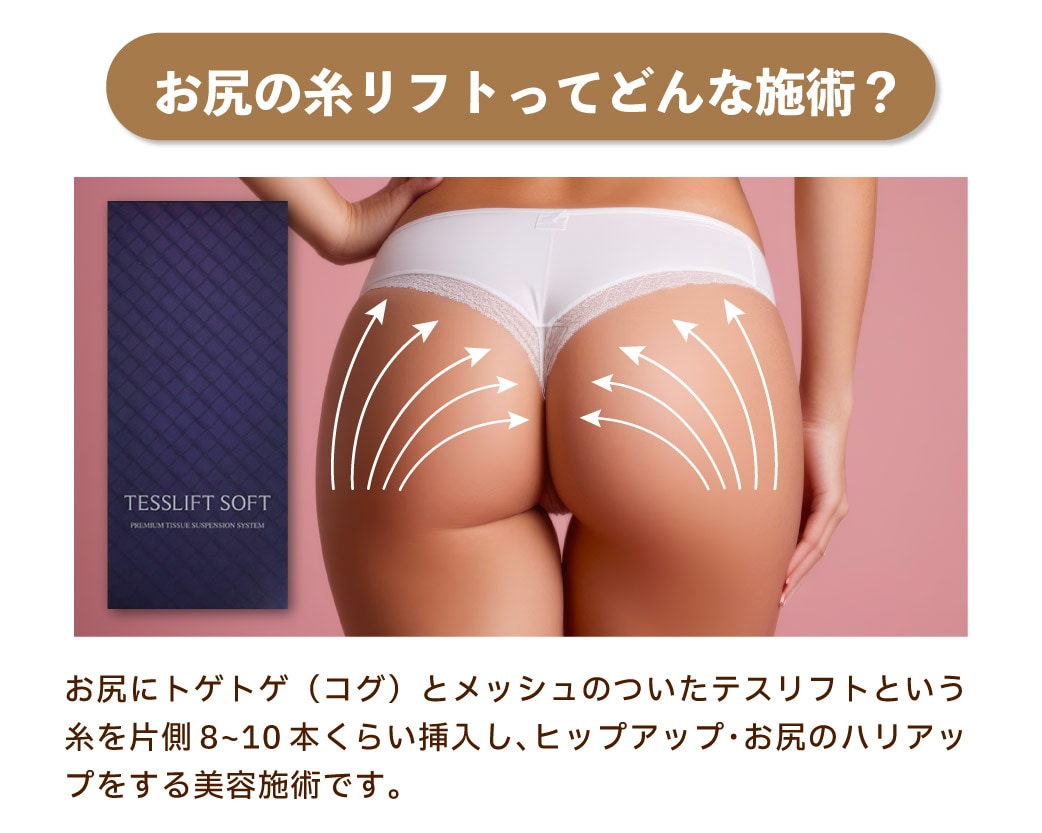 ２つ以上の尻 垂れ尻を解消！お尻の糸リフトが導入決定！究極のヒップアップ術最新治療バッドリフトが遂に銀座でも！ - 銀座院