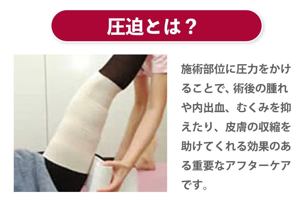 脂肪吸引の圧迫はいつまですればいい？しなかった場合はどうなるのかも 