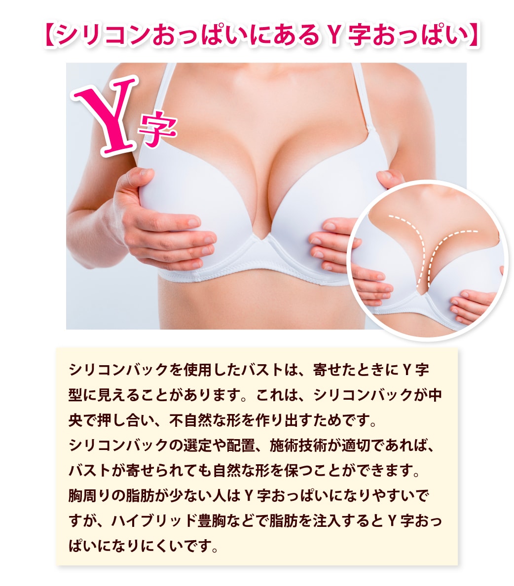 日本人 偽物豊胸おっぱい 