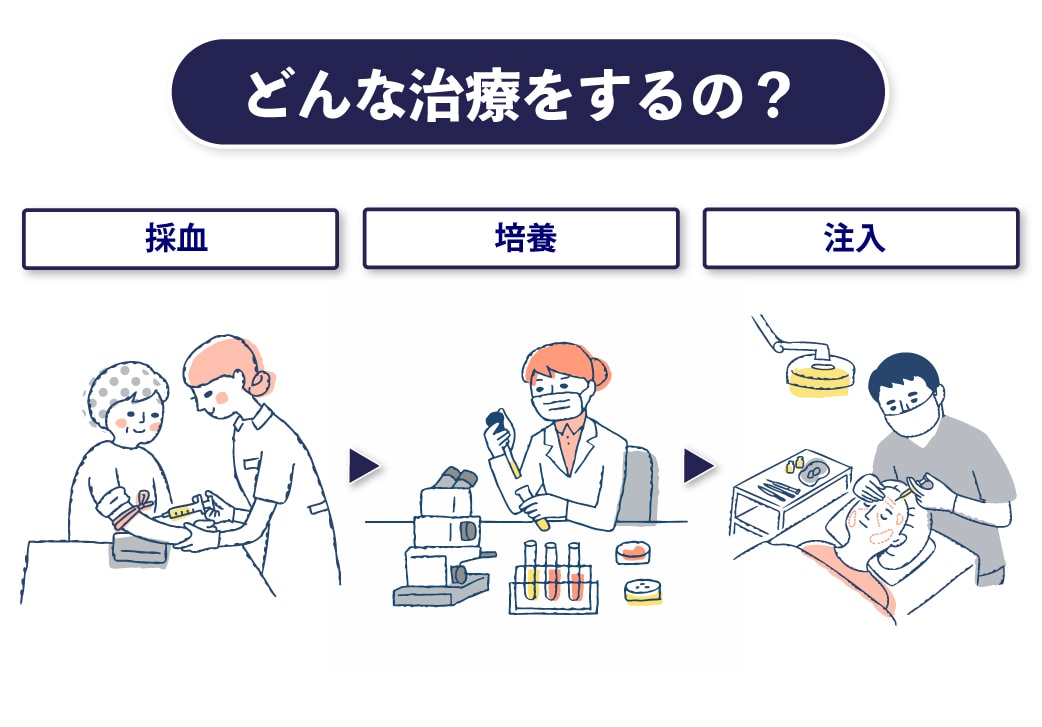 PRP皮膚再生治療は何をするの？