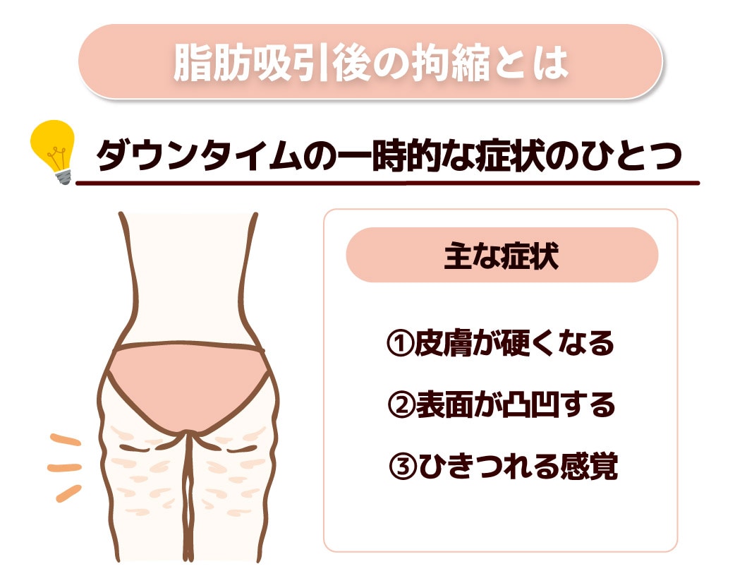 腹ボコ  写真 