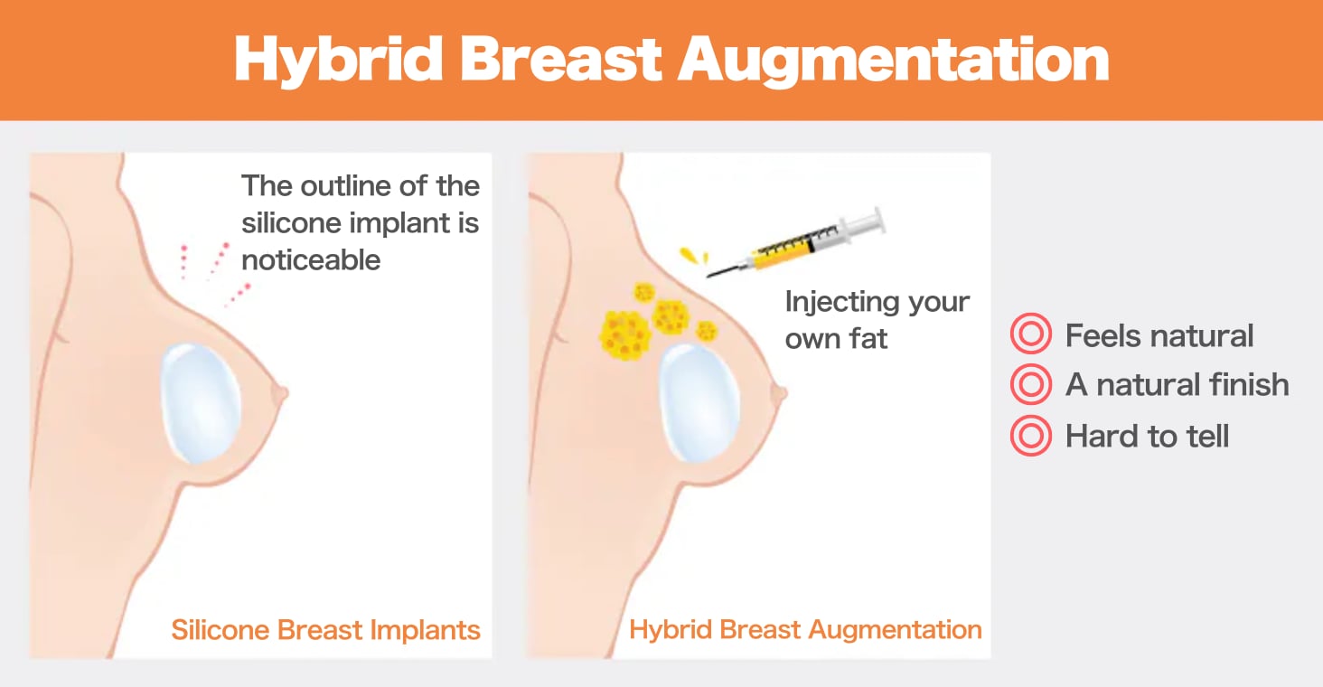 3.Hybrid breast augmentation