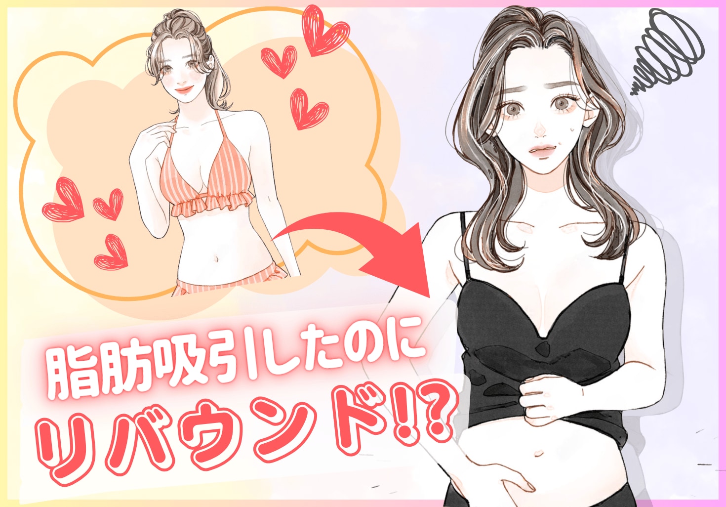 【脂肪吸引後に太った!?】脂肪吸引後にリバウンドしてしまうケースとは？対策と注意点！
