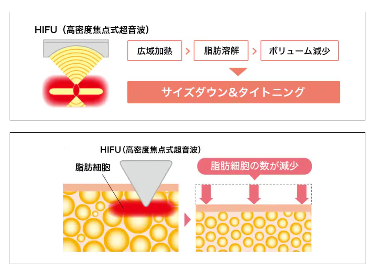 ハイフとは?