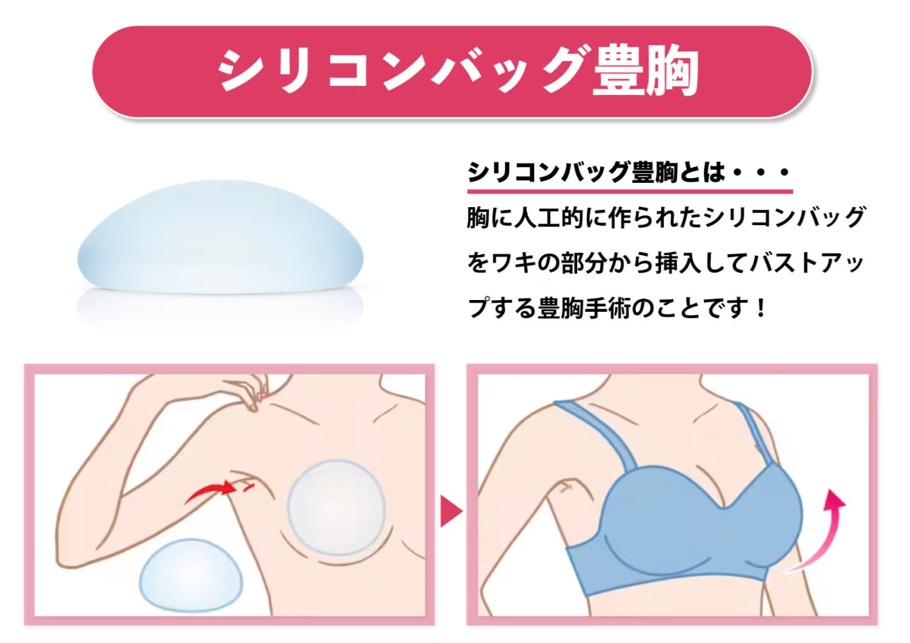 最新の施術法と特徴