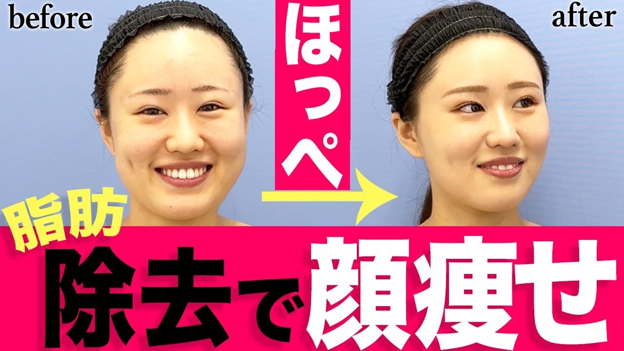 口の中の何回も同じところを噛む人必見！手術でどう変わる？