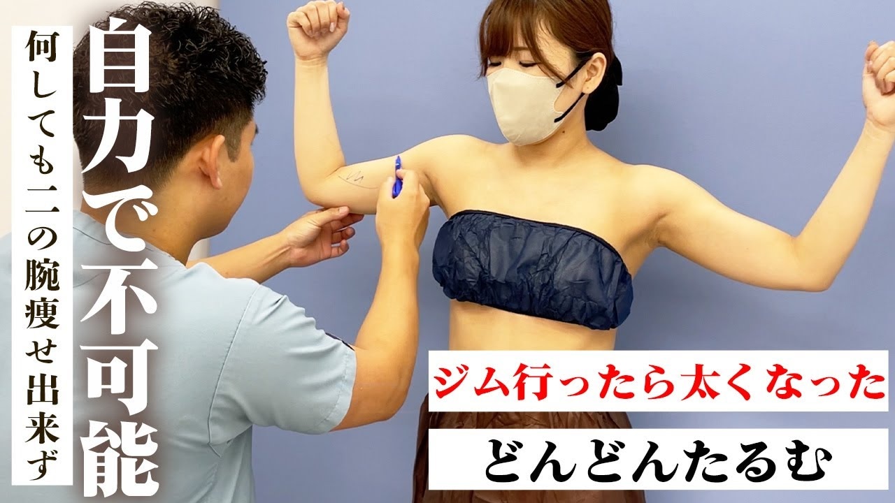 二の腕の筋トレで太くなった女性スタッフが脂肪吸引！理由を聞いてみた