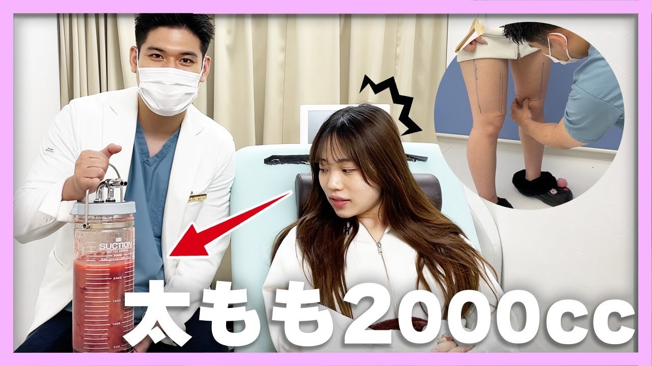 太ももだけ太いのを解消したい！脂肪吸引する女性YouTuberに密着