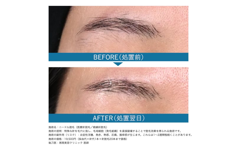 施術直後から効果を実感できる🙆‍♀️