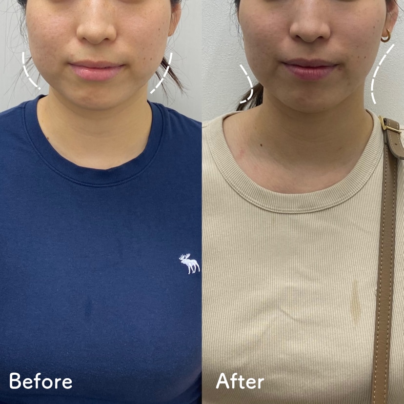 たった1回でこんなに変わる✨