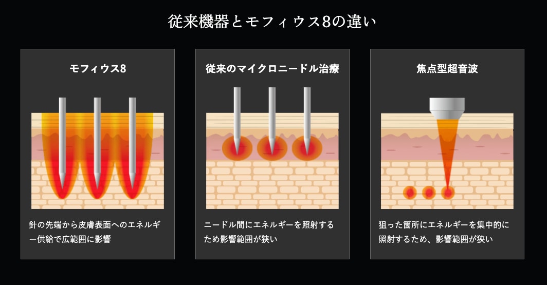 “たるみ・毛穴・肌質改善”すべてにアプローチできる理由