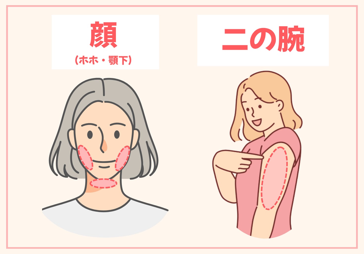 当日対応可能な部位