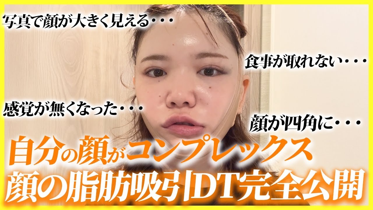 笑うと顔が大きくなる悩みを解消！顔の脂肪吸引でどう変わる？