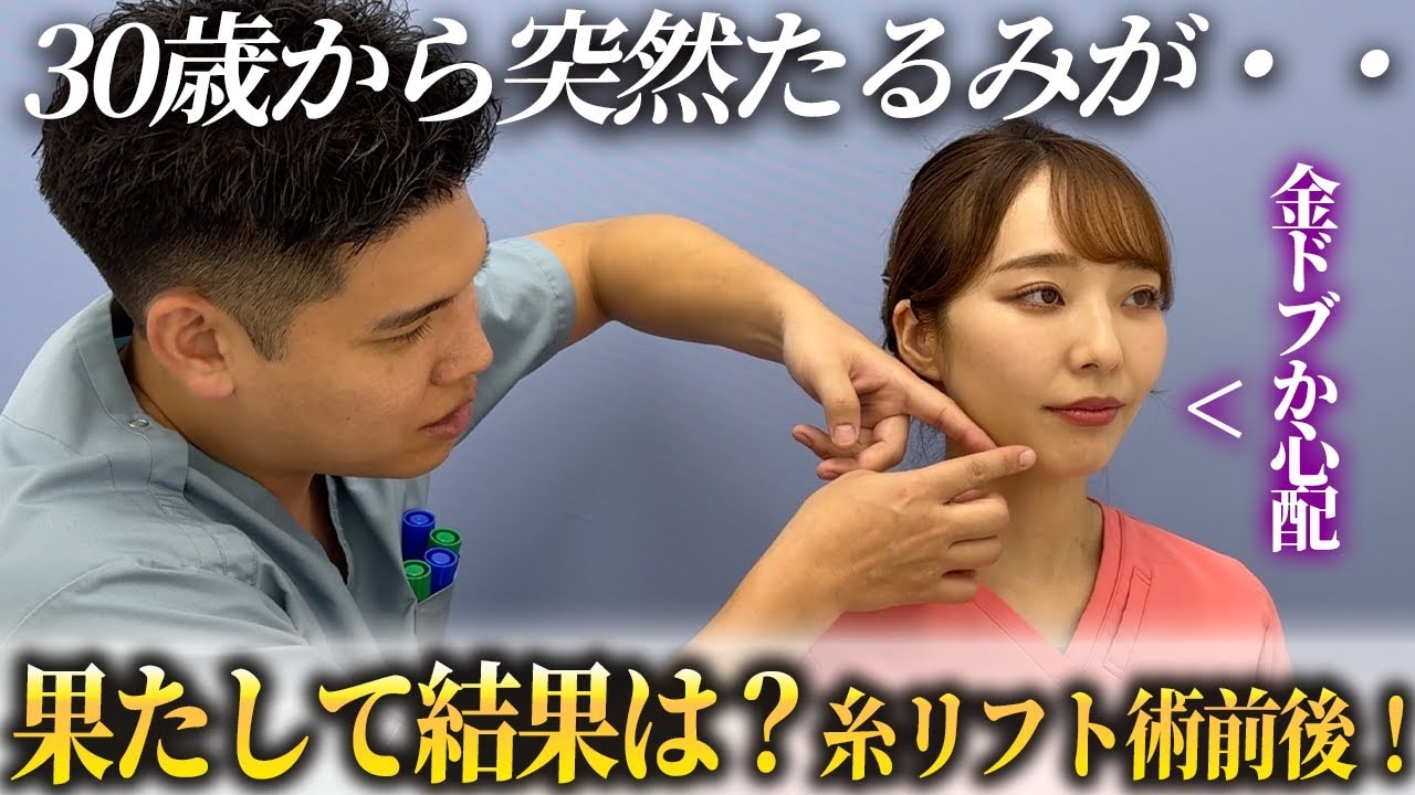 顎下のたるみは糸リフトで改善できる？適応の人・適応じゃない人の特徴