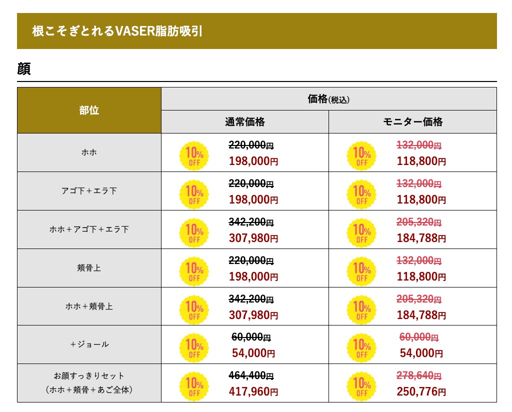 【ベイザー脂肪吸引】料金表