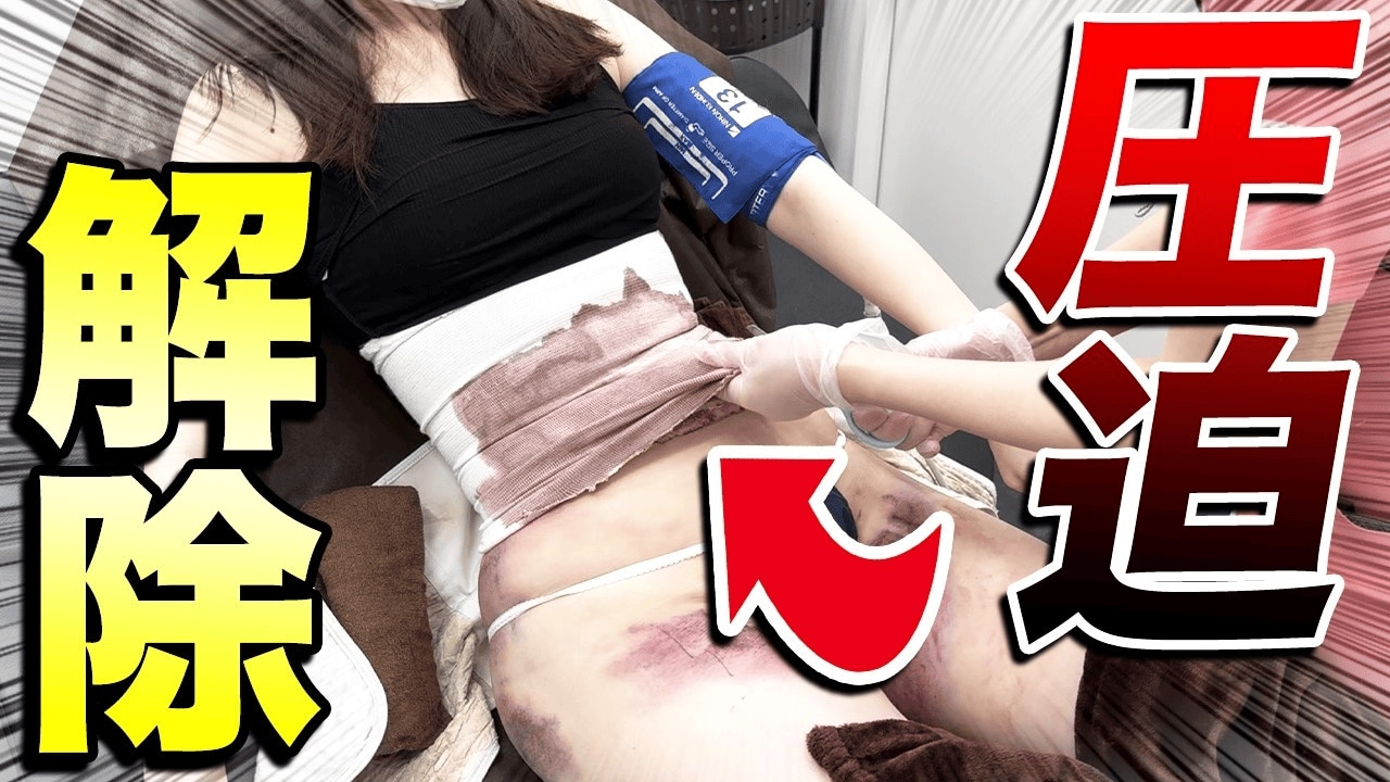 背中の肉がつまめるのはやばい？見落としがちな部位も綺麗に脂肪吸引！