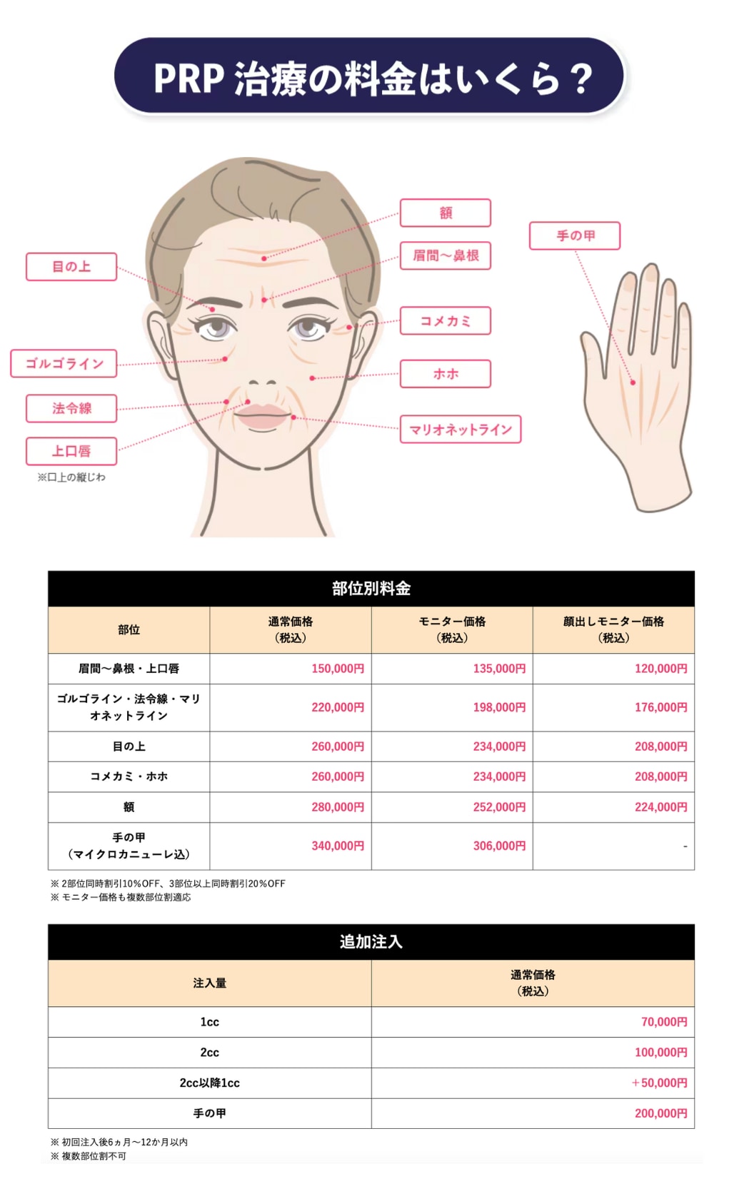 PRP皮膚再生治療はいくらでできる？