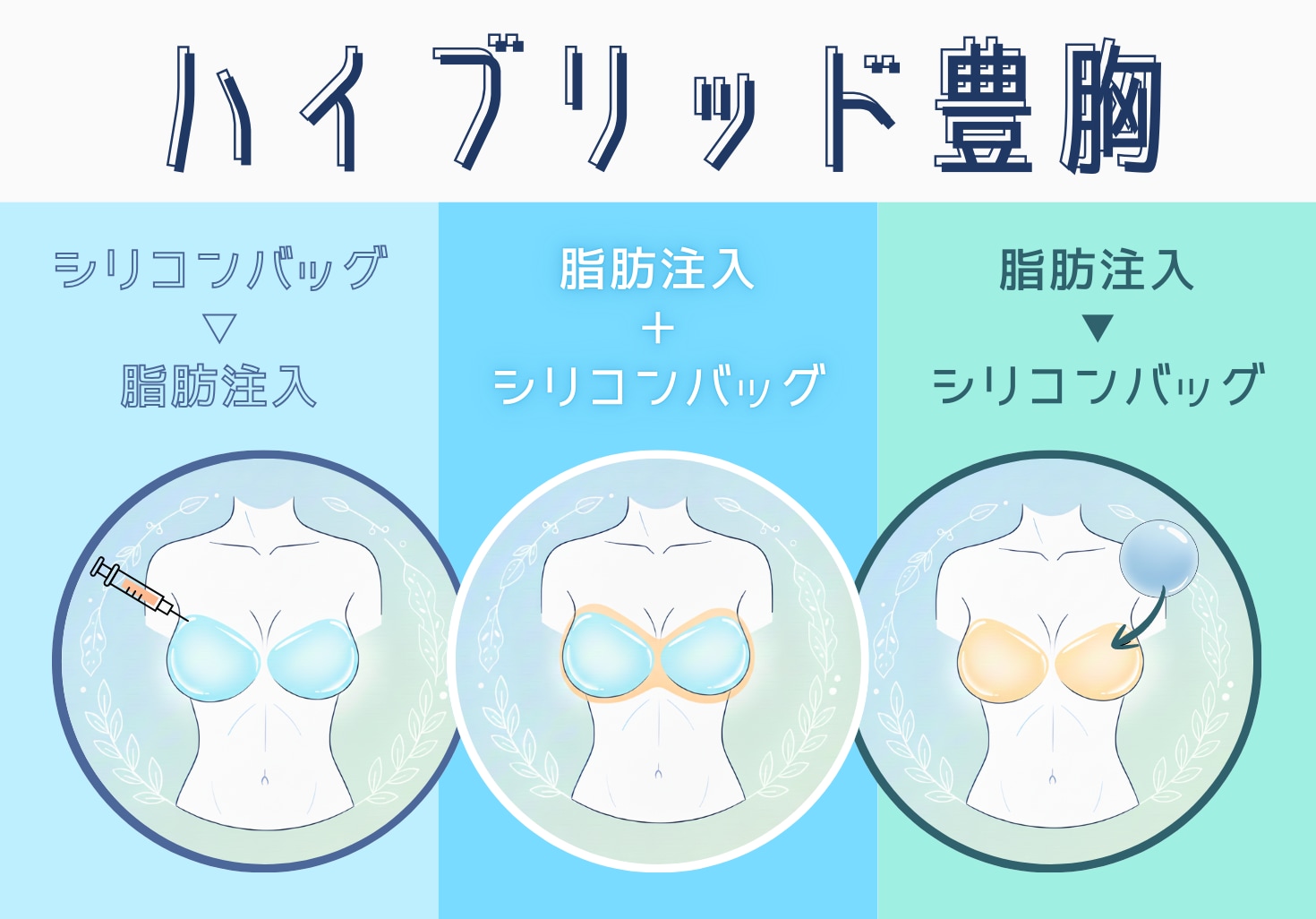 ハイブリッド豊胸には3つの方法があるの知ってる?気になる症例も紹介!