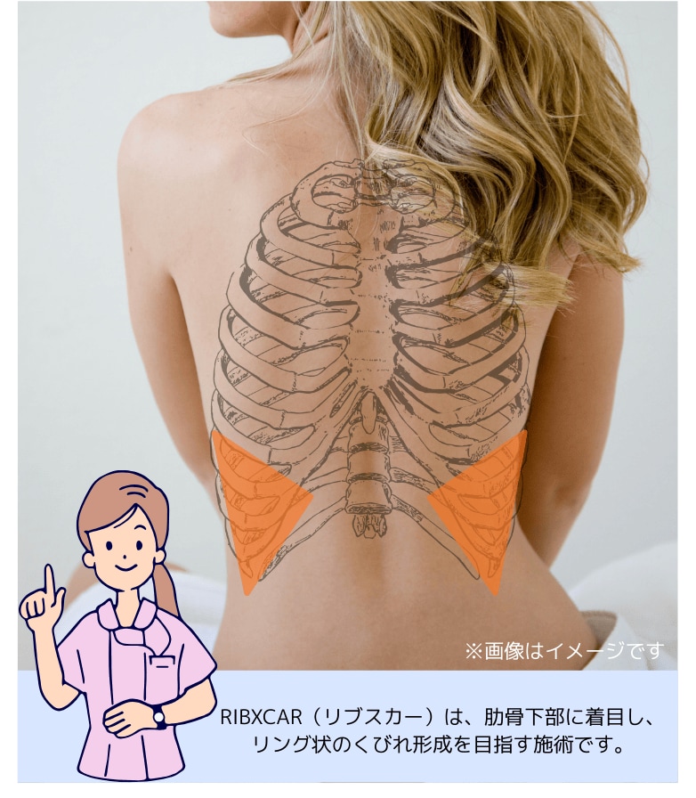 肋骨からくびれを形成