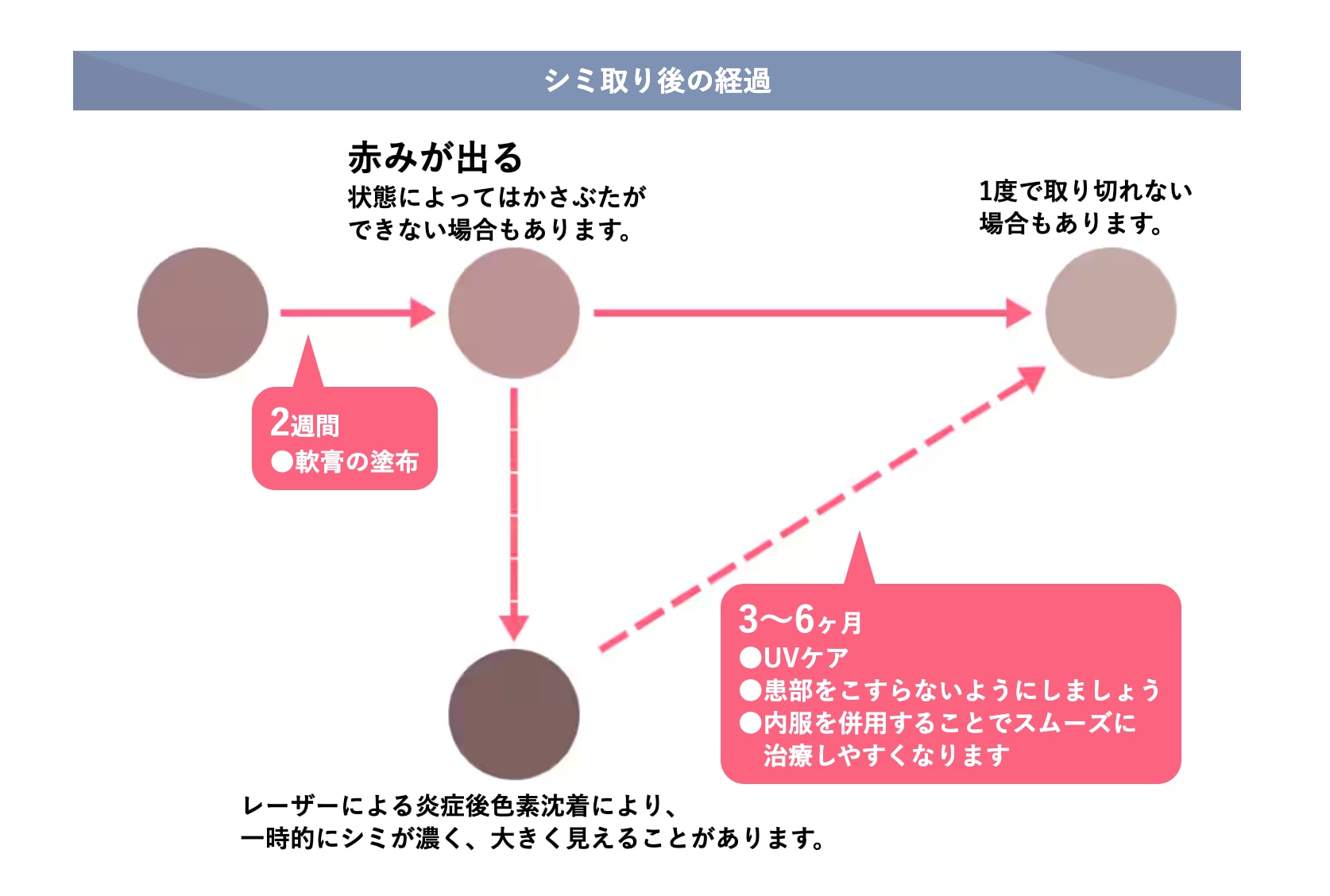 気になるシミ、すぐ消えてくれる？