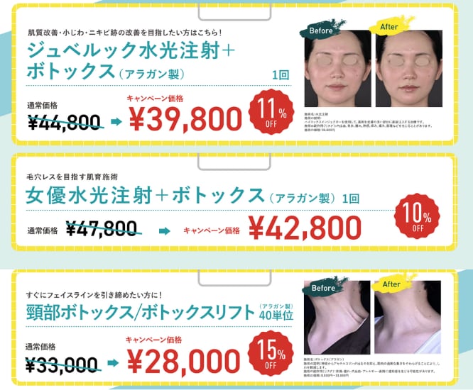 このチャンスを逃さないで！