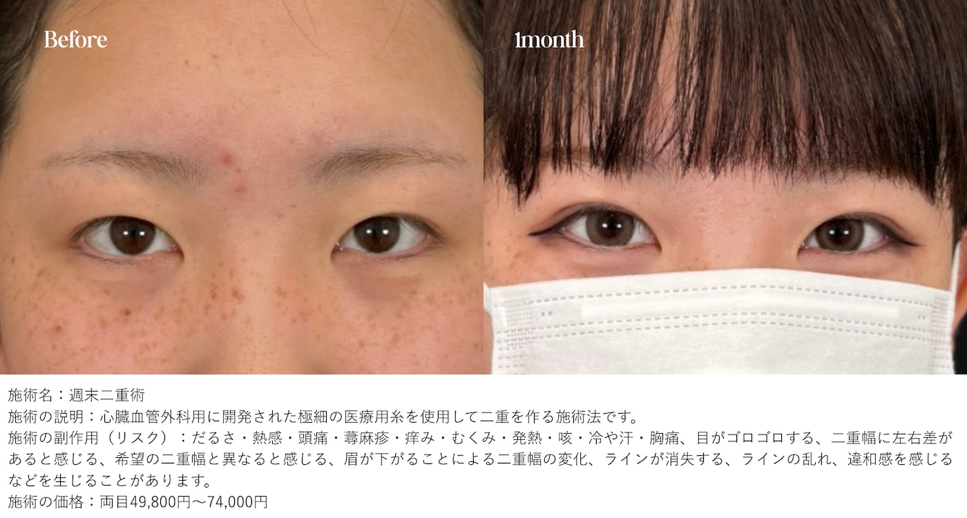 週末二重®キャンペーン｜最大60%OFF‼️3月31日まで🫧