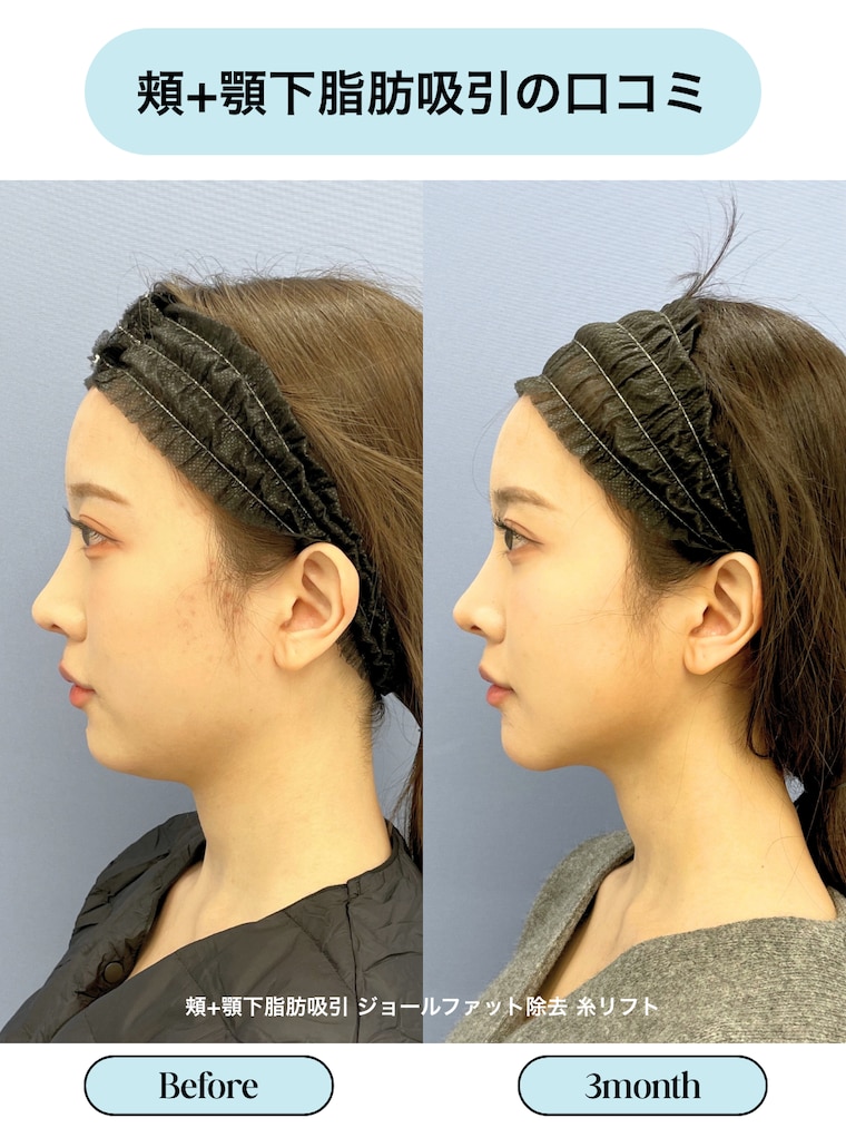 評判・口コミ・効果とは？