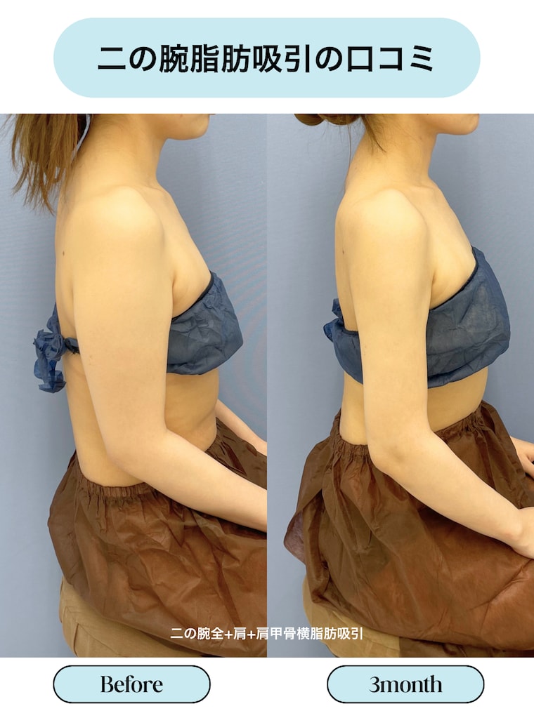 評判・口コミ・効果とは？