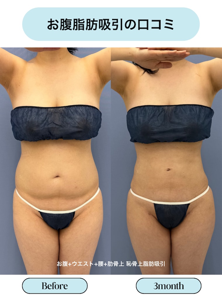 評判・口コミ・効果とは？