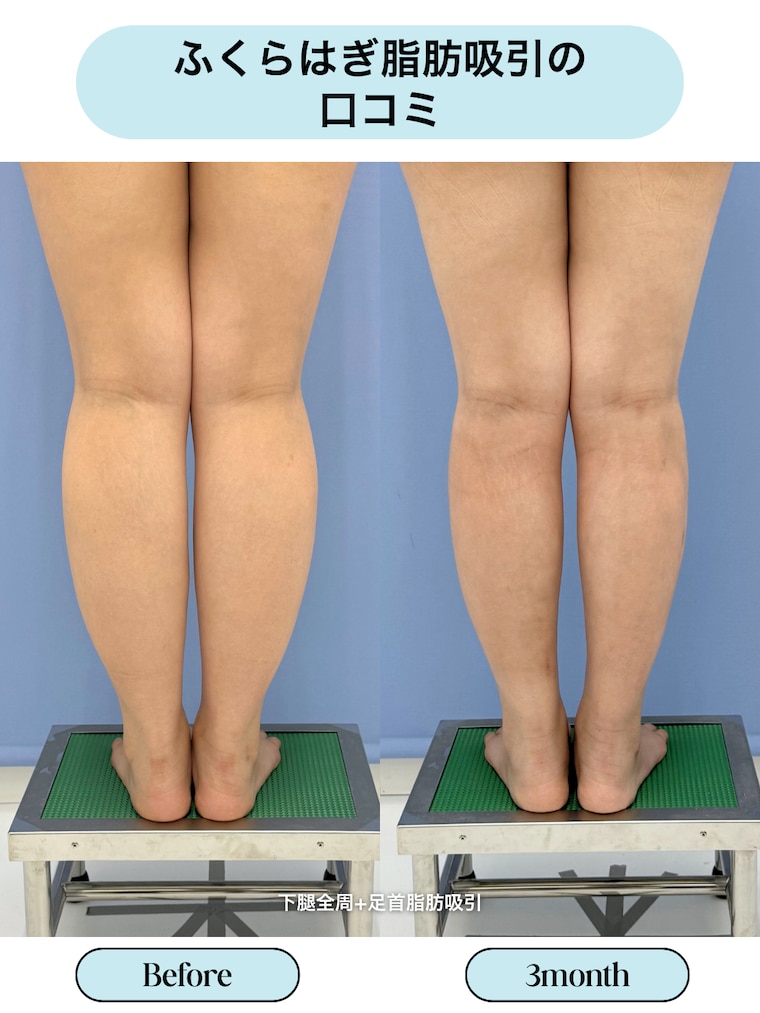 評判・口コミ・効果とは？