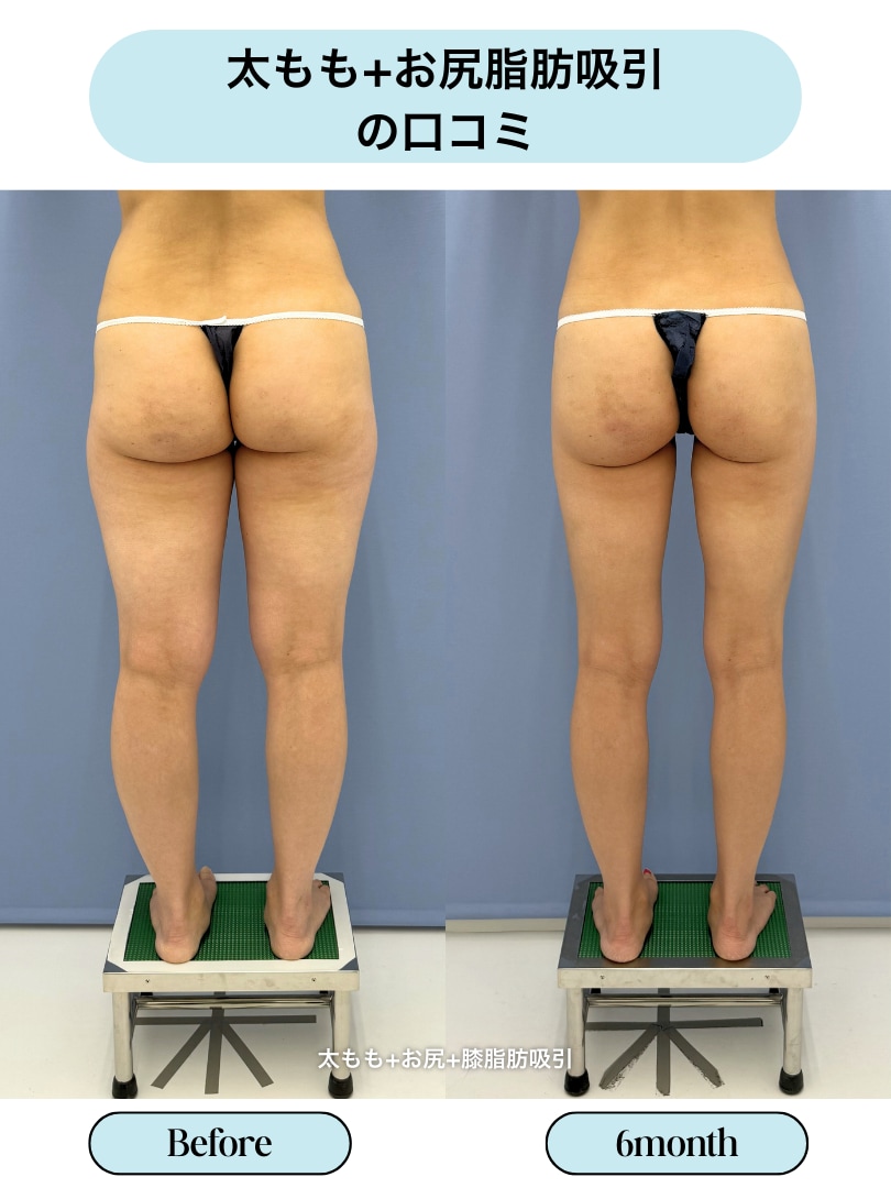 評判・口コミ・効果とは？