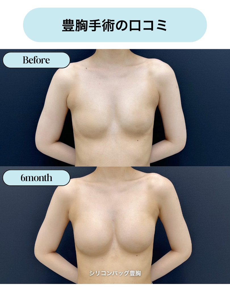 評判・口コミ・効果とは？