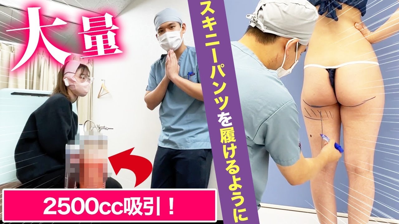 スキニーを履きこなしたい!足が太いから似合わないと悩むスタッフに密着