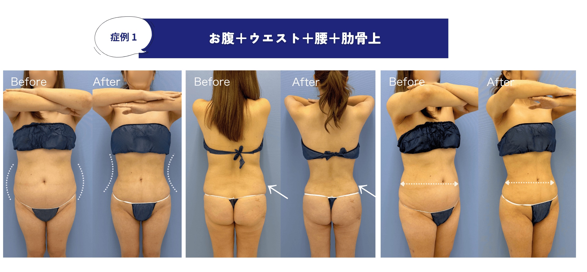 術前・術後の変化