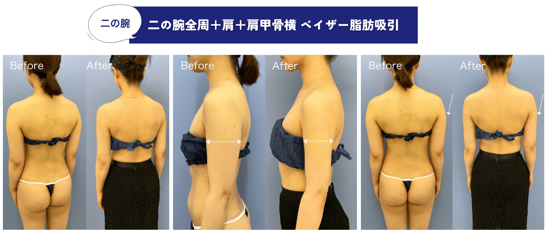 ビフォーアフター