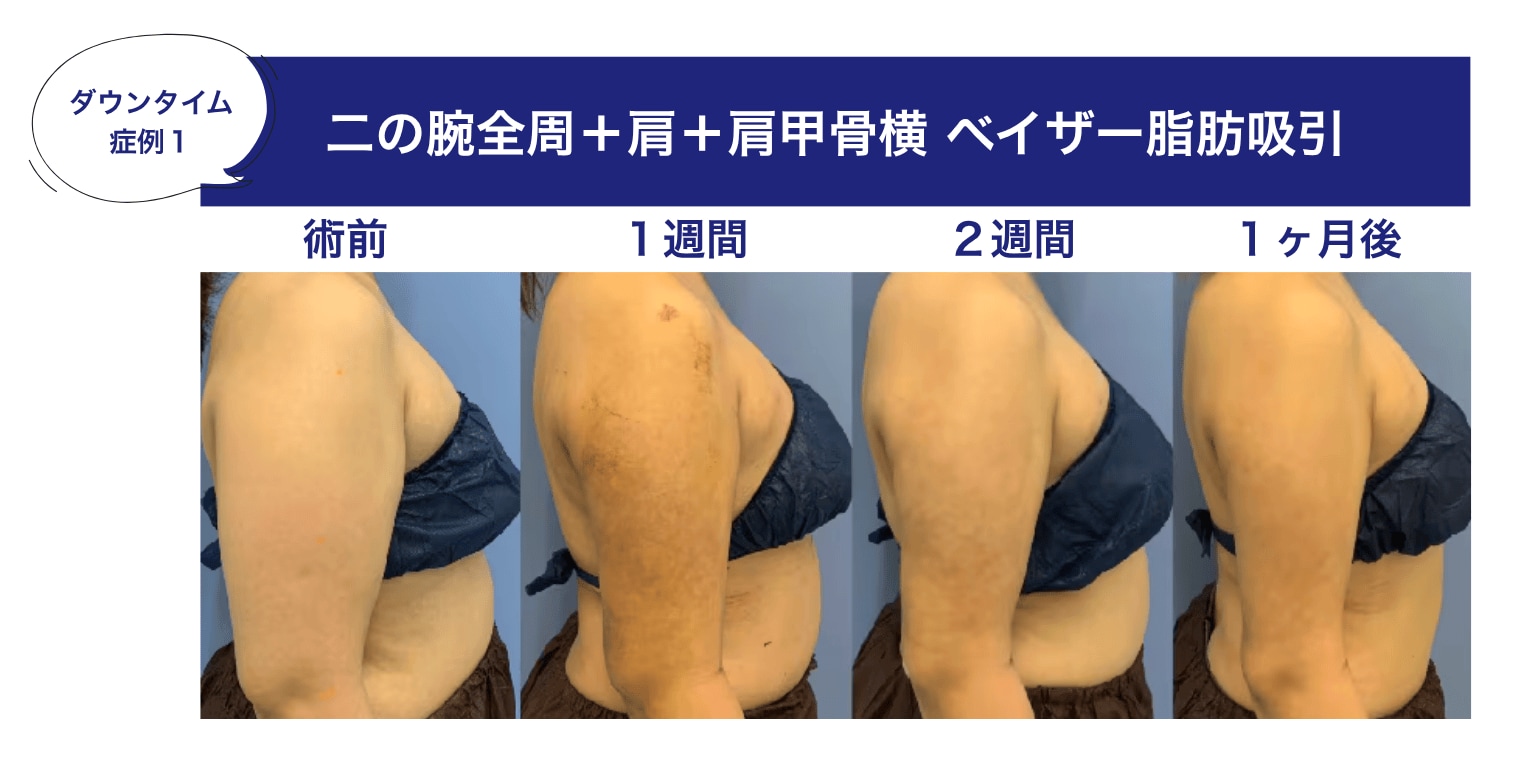 ビフォーアフター