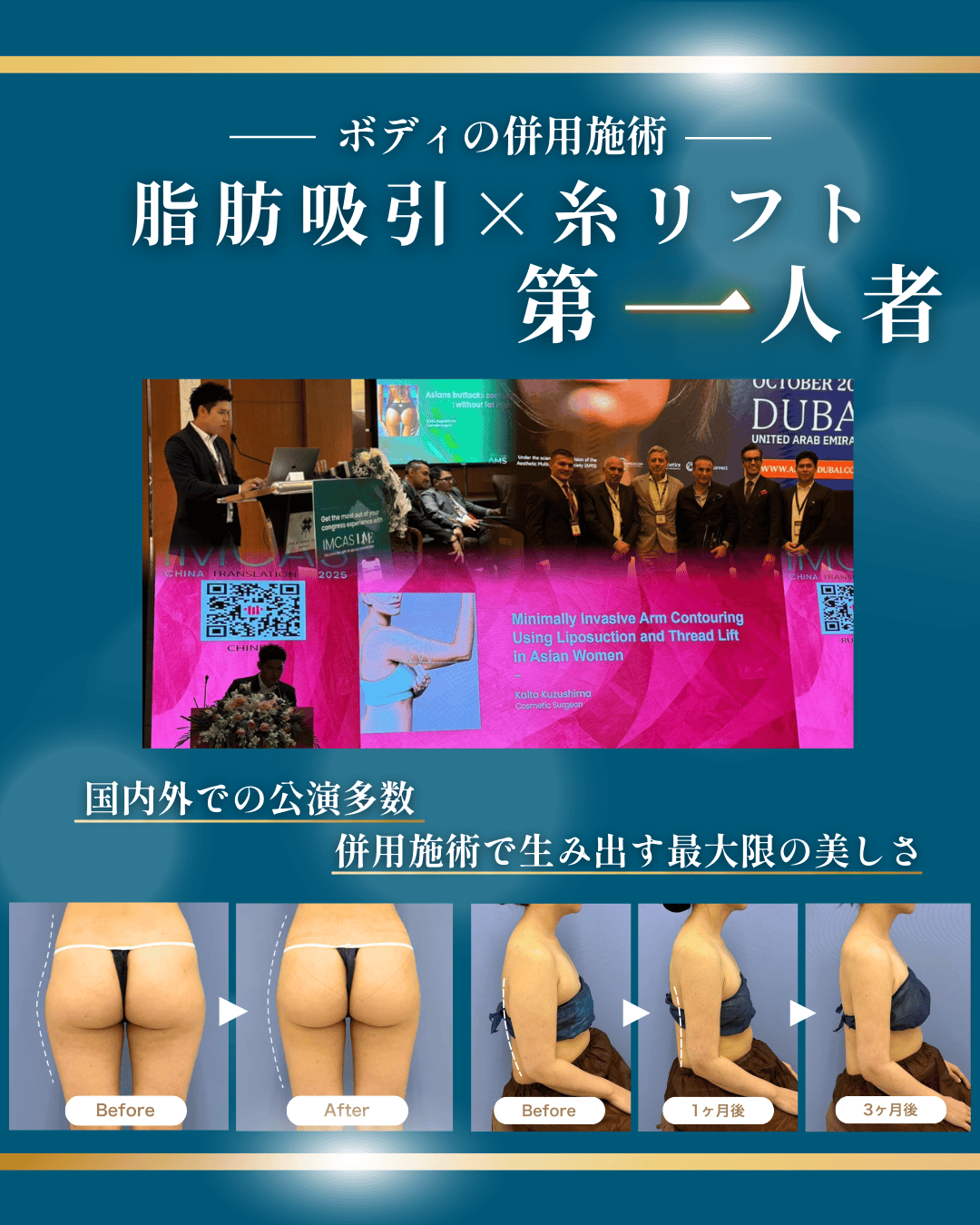 ボディの糸リフトができるのは、SBC内で葛島医師だけ