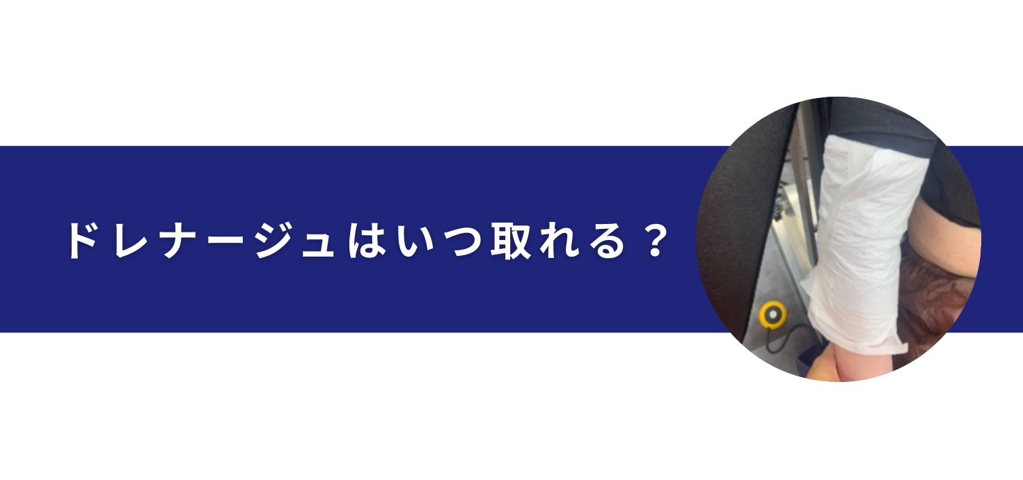 ドレナージュはいつ取れる？
