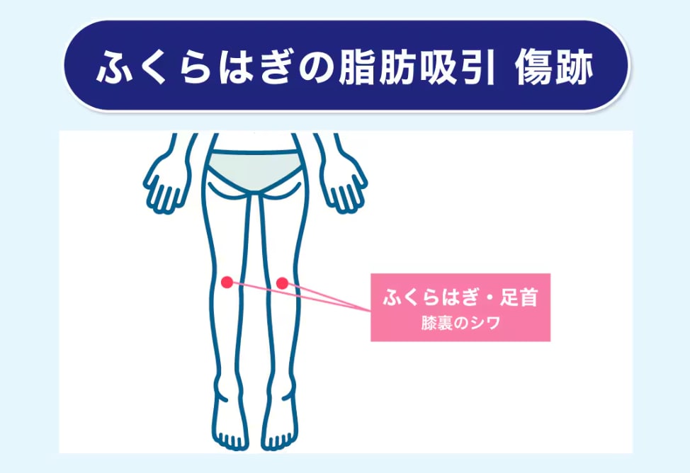 目立たない場所に作ることが大事