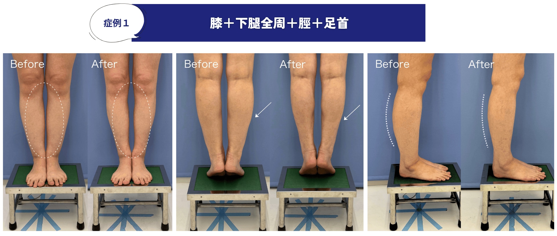 術前・術後の変化