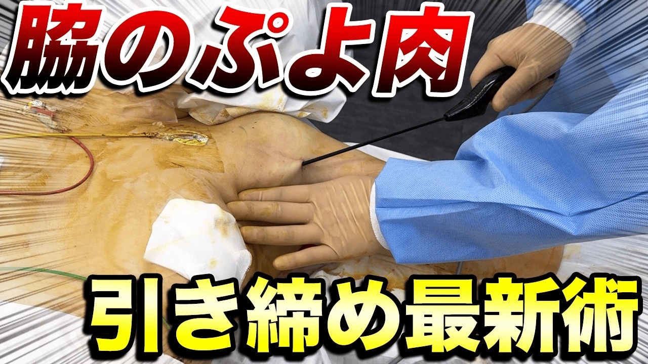 脇肉のぽっこりを脂肪吸引で解消！満足のいく仕上がりにするためには？