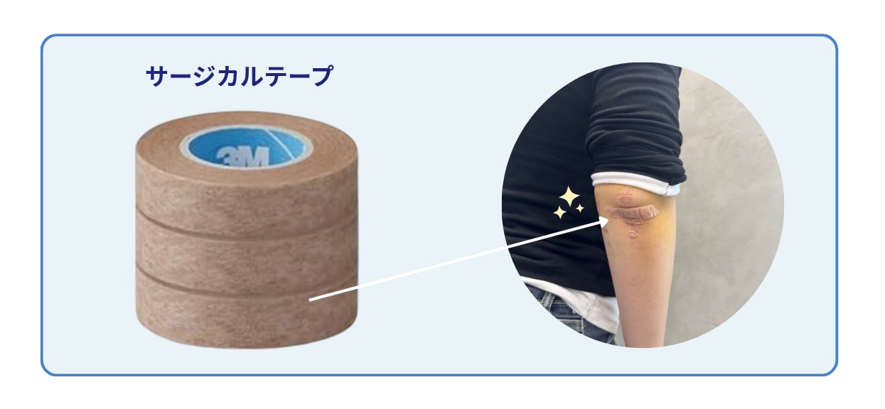 ① 傷跡はテープで保護する