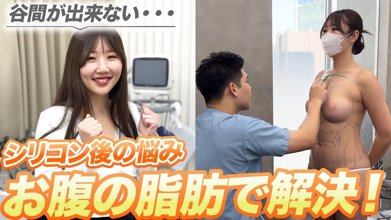 鳩胸は脂肪注入豊胸で解消できるのか？スタッフの施術に密着