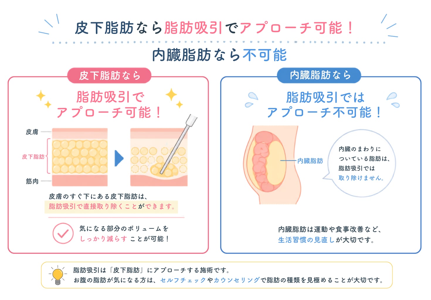 脂肪吸引という選択肢