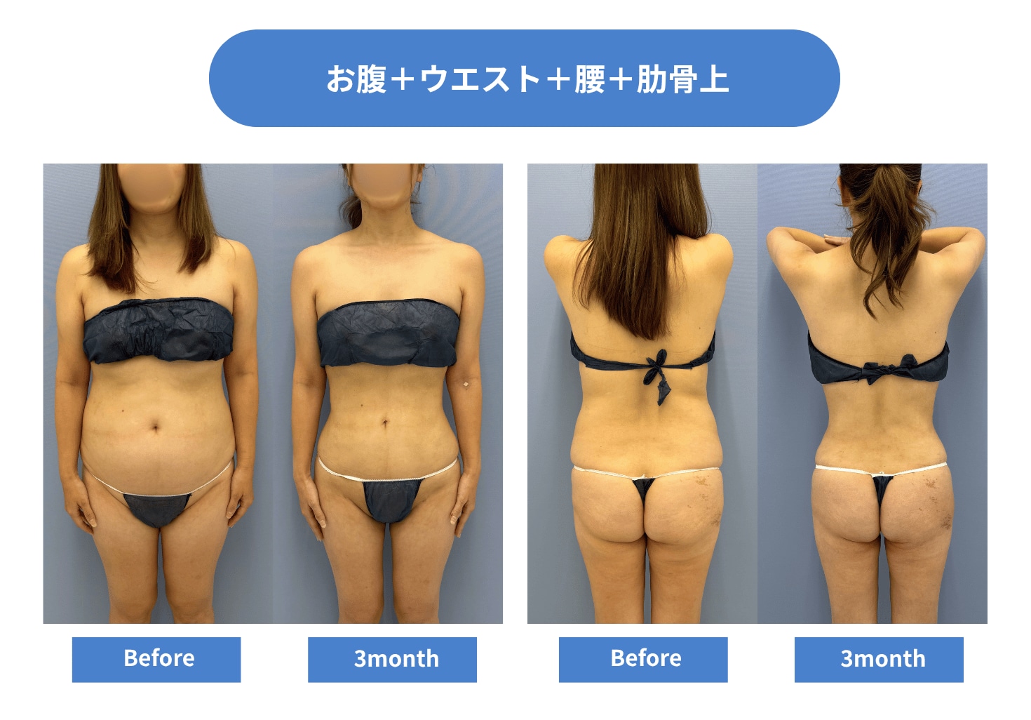 CASE 01